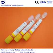 Вакуумные пробирки для сбора крови Sst Tube (ENK-CXG-020)